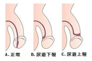 性功能障碍